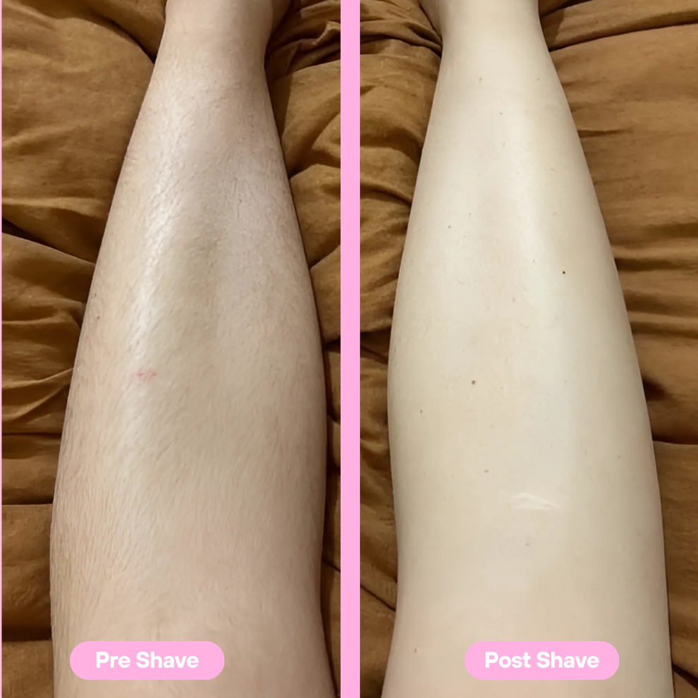 Kemie 5-in-1 Beauty Shaver - Easy Hair Removal, Best Self-Care Gift
