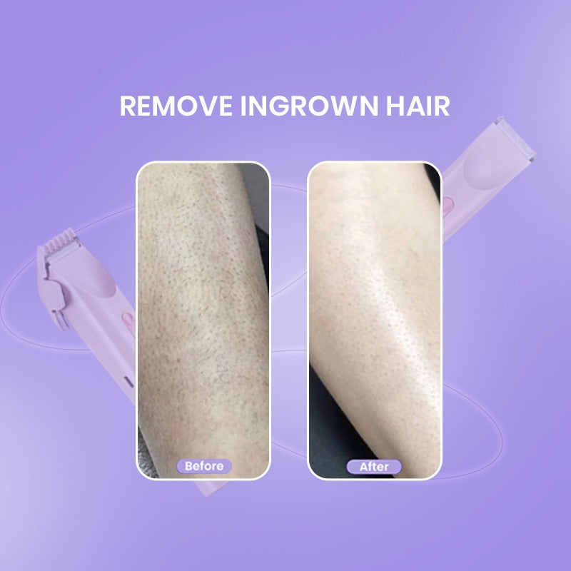 2 in 1 Women Beauty Shaver - Easy Hair Removal, Best Self-Care Gifts
